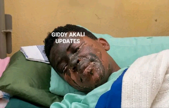 I Was Worried About Claire’s Eyesight